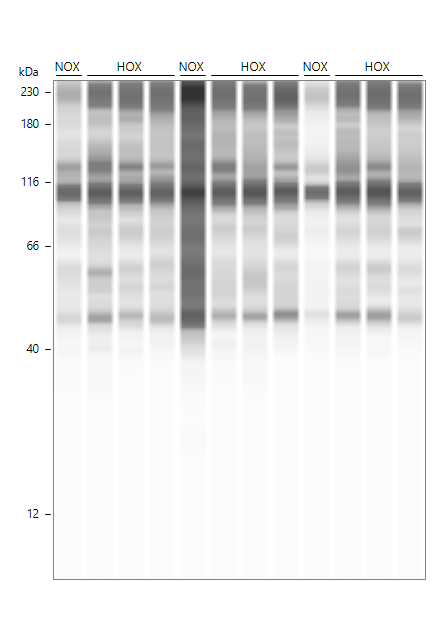 Adenine Nucleotide Translocase 1 Antibody - BSA Free NBP2-92642
