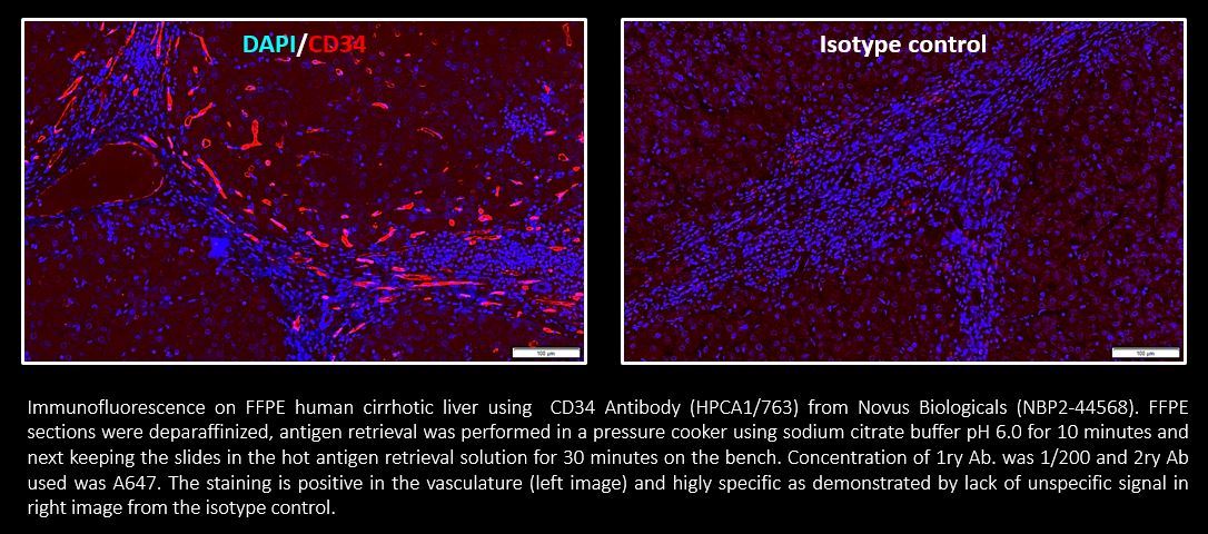 CD34 Antibody (HPCA1/763) NBP2-44568