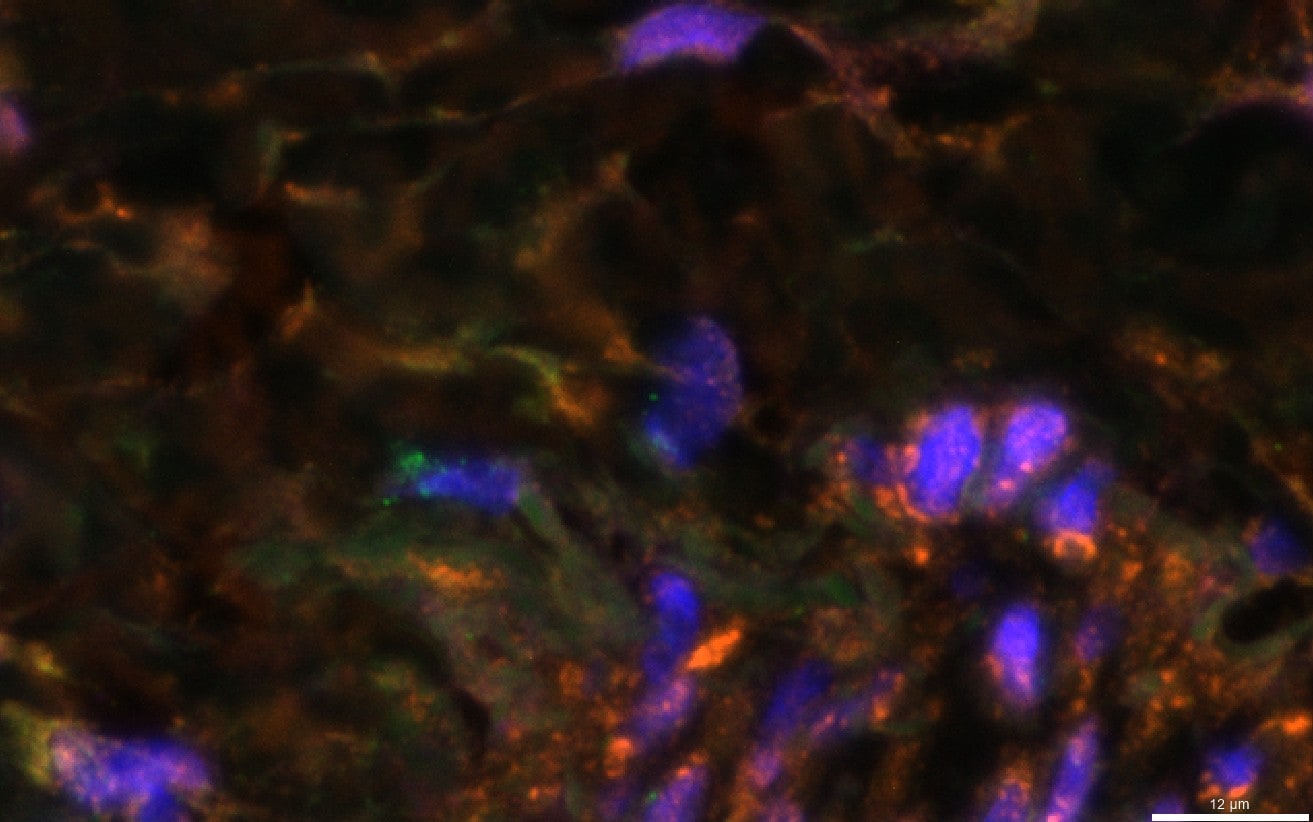 53BP1 Antibody - BSA Free NB100-304