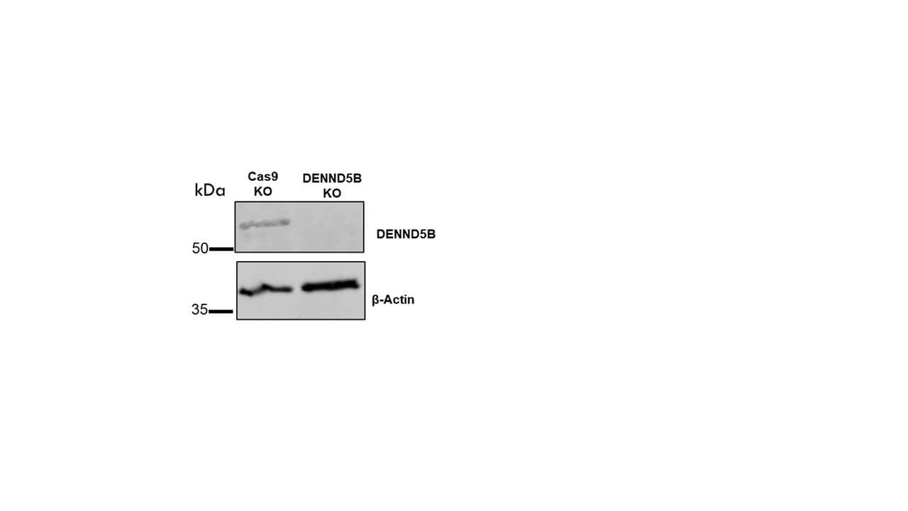 DENND5B Antibody - BSA Free NBP2-31971