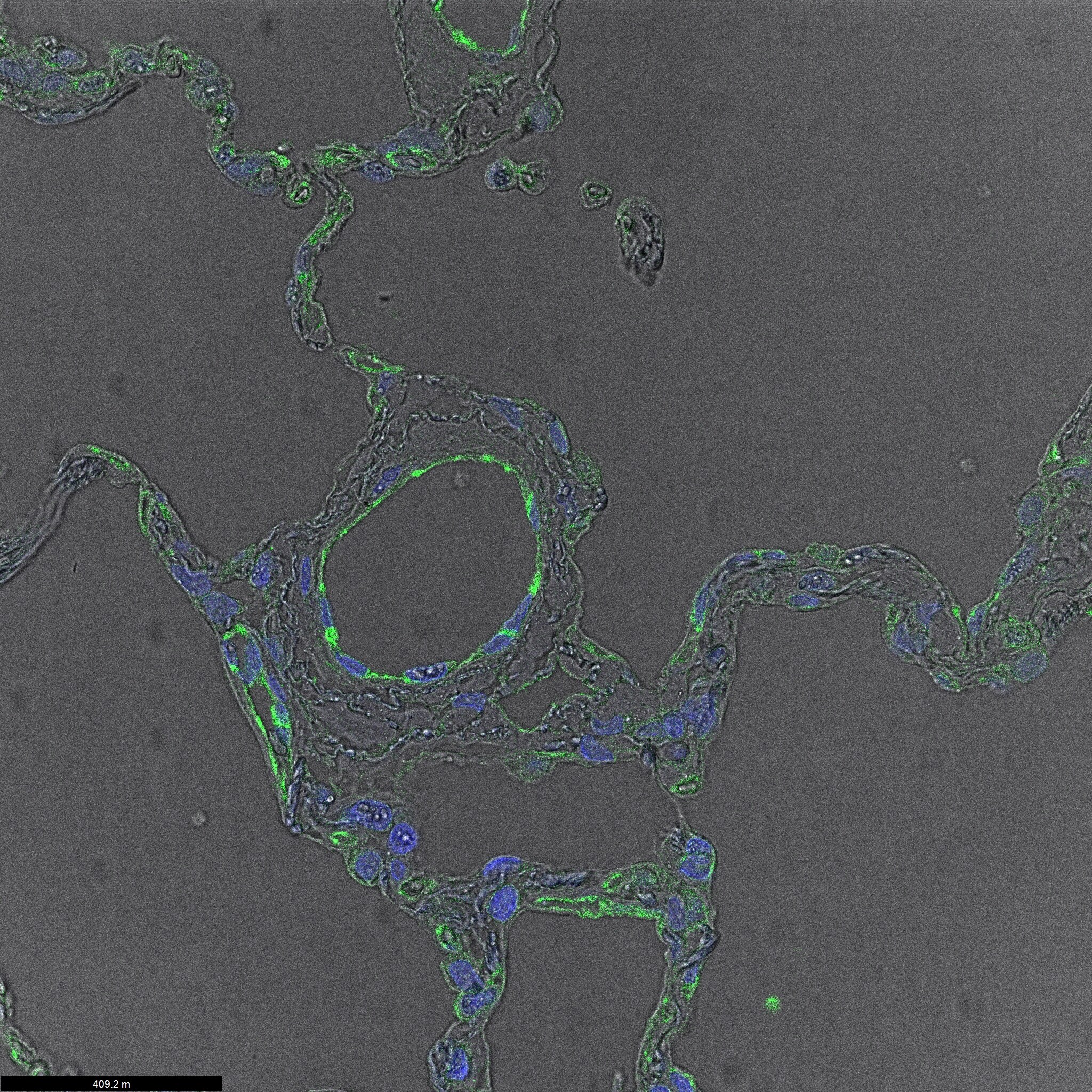 CD31/PECAM-1 Antibody NB100-2284