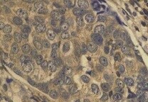 Human VEGF‑D Antibody MAB286