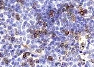 Human CD43 Antibody MAB20381