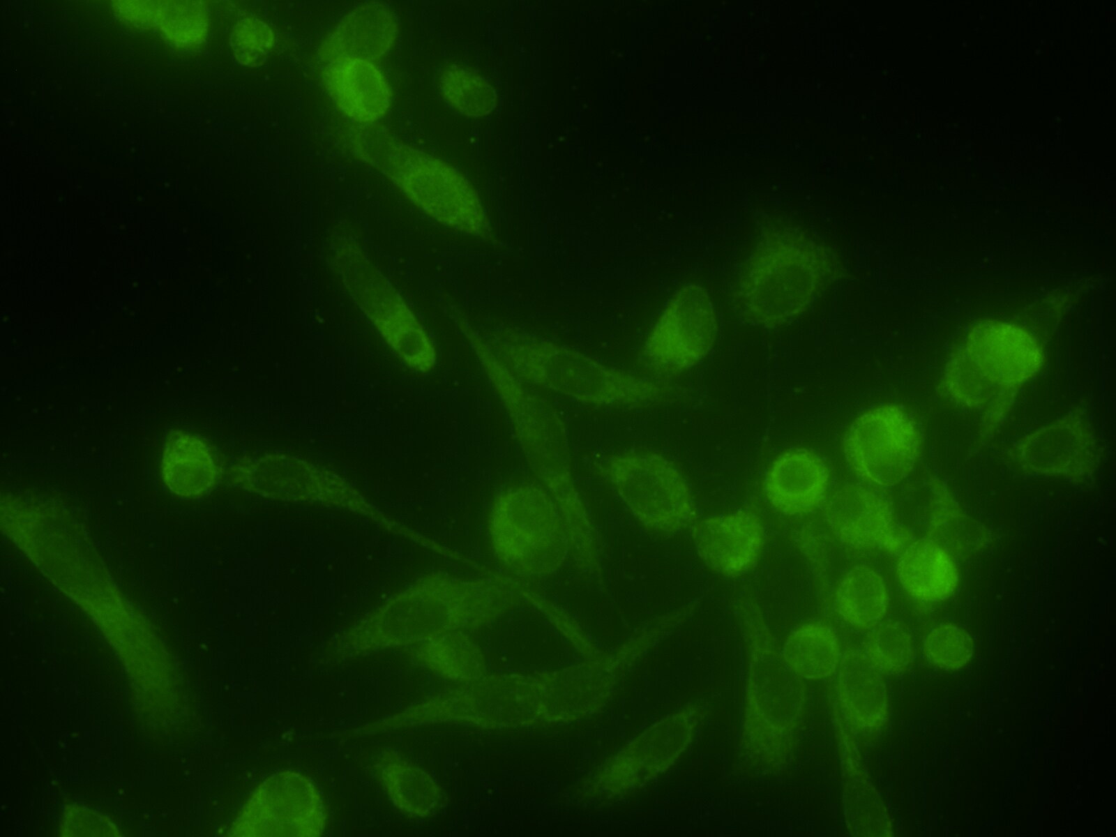 Ribophorin I Antibody (OTI3H3) NBP2-01294