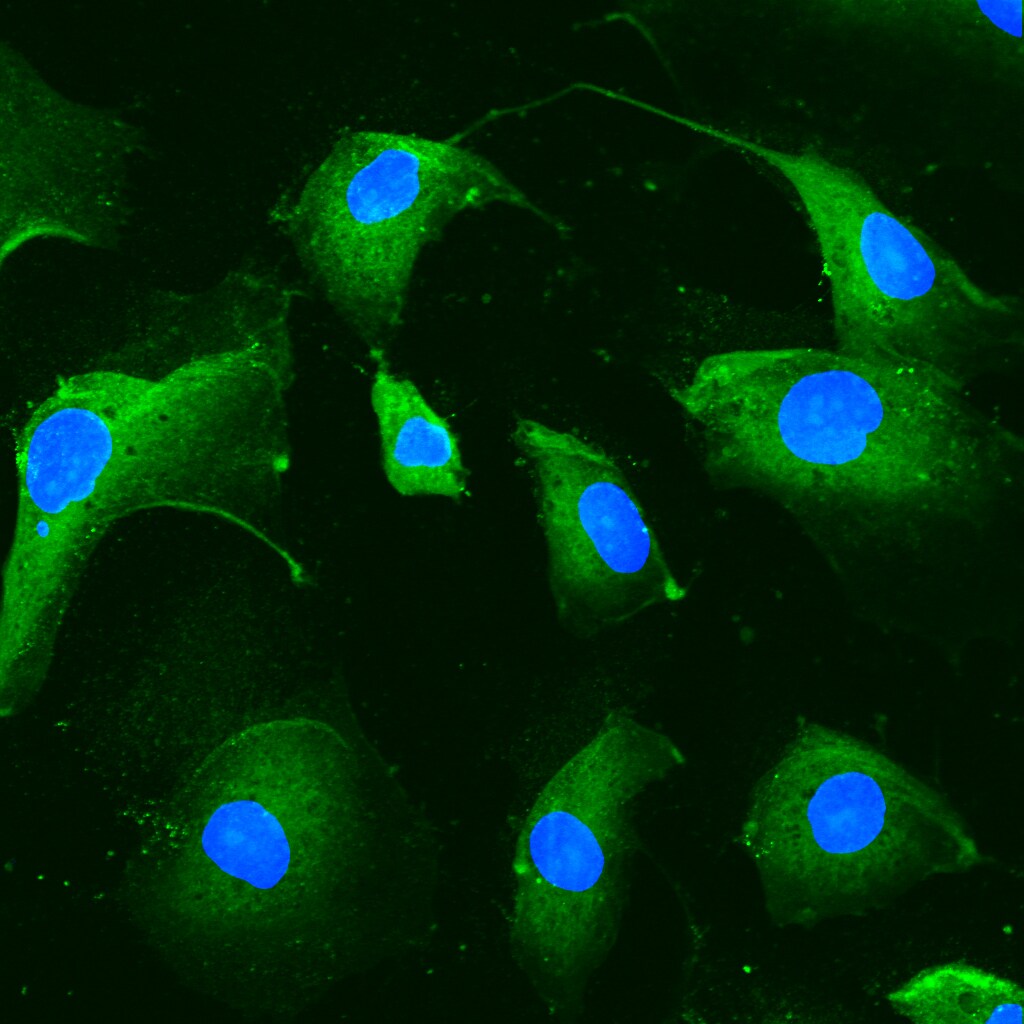 CD39/ENTPD1 Antibody - BSA Free NBP1-90071