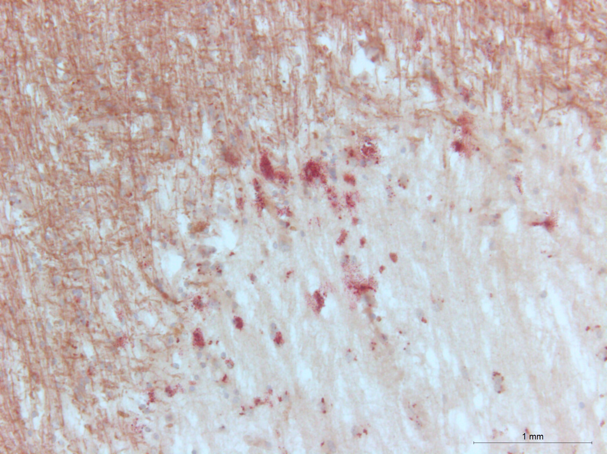 LC3 Antibody Pack NB910-40435