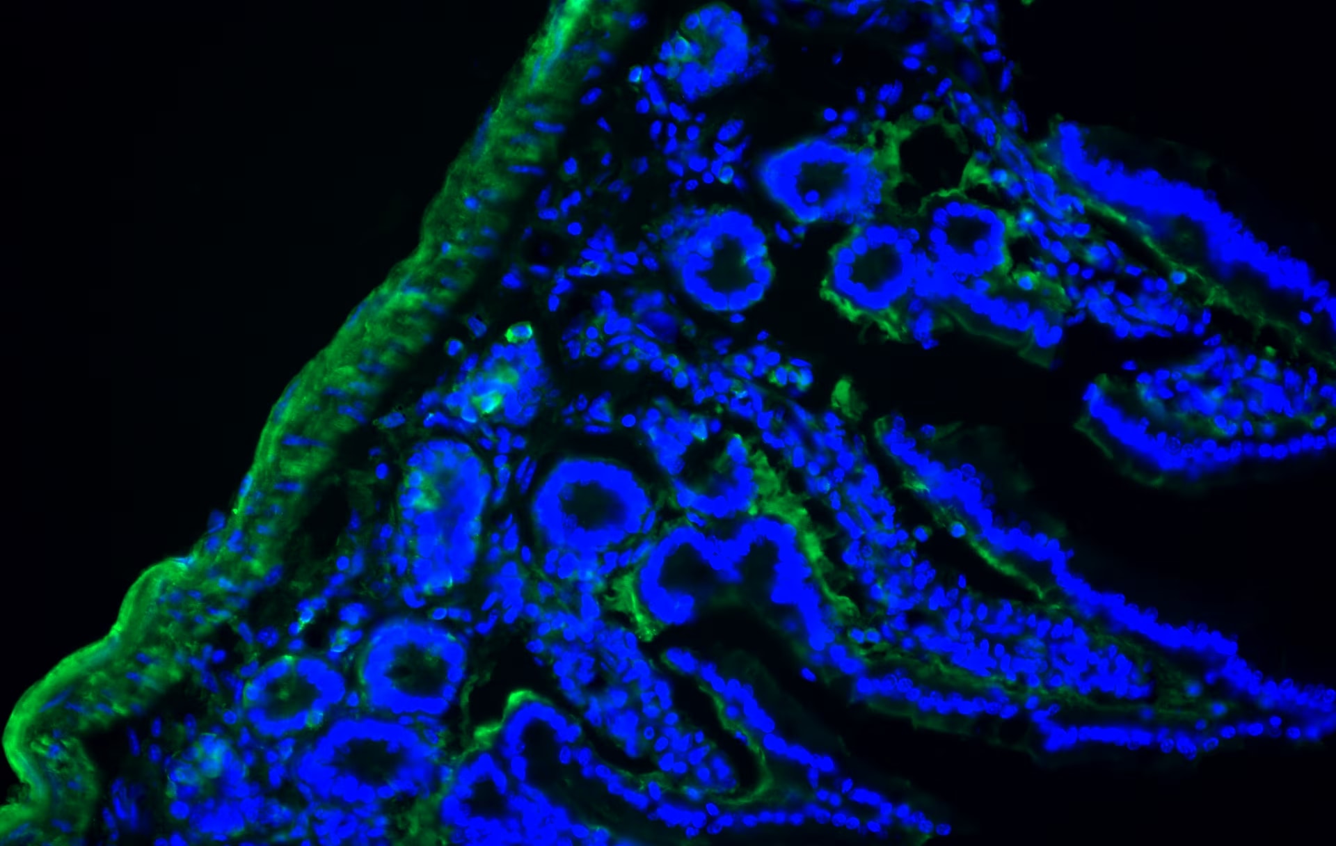 Human PDGF R alpha  Antibody MAB322