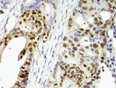 Human MMP‑25/MT6-MMP Hemopexin Domain Antibody MAB11421