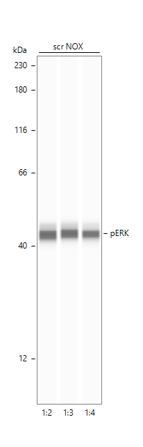 Human/Mouse Phospho-ERK1 (ERK1 T202/Y204, ERK2 T185/Y187) Antibody MAB18251