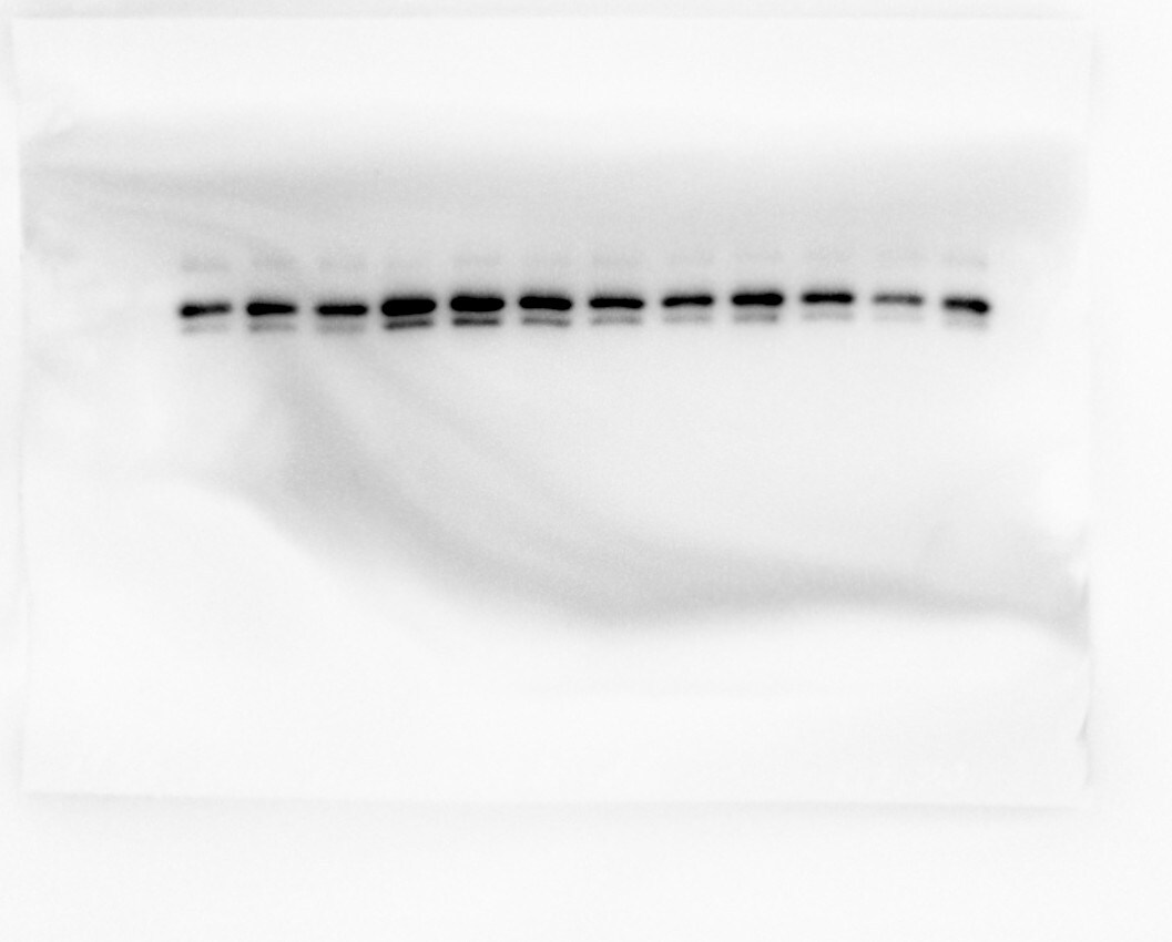 Human/Mouse Phospho-ERK1 (ERK1 T202/Y204, ERK2 T185/Y187) Antibody MAB18251