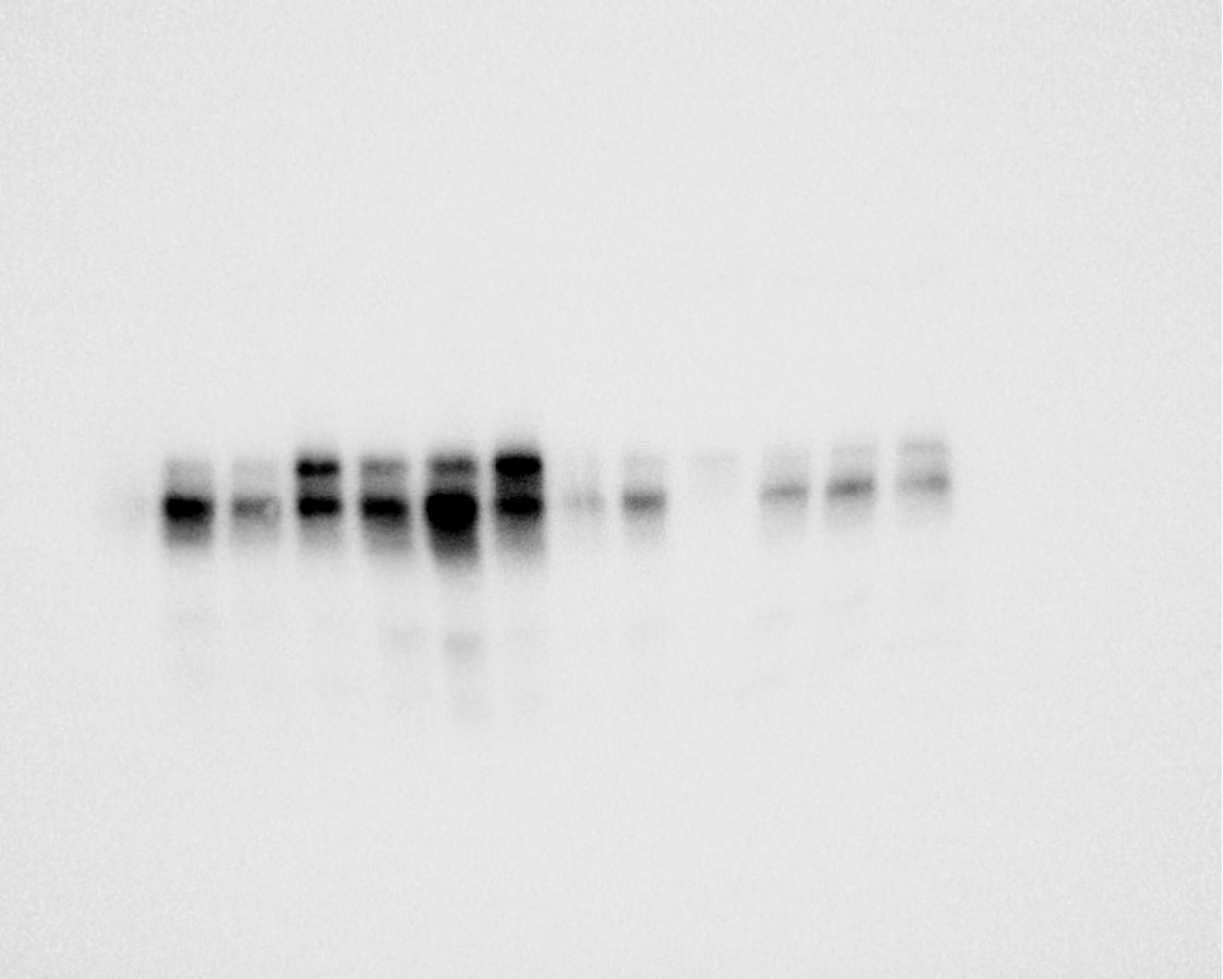 Human/Mouse/Rat RAGE/AGER Antibody AF1145