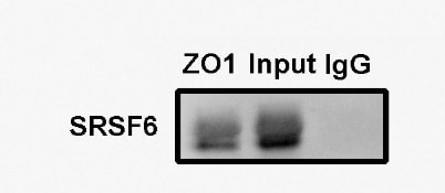 Normal Human IgG Control 1-001-A