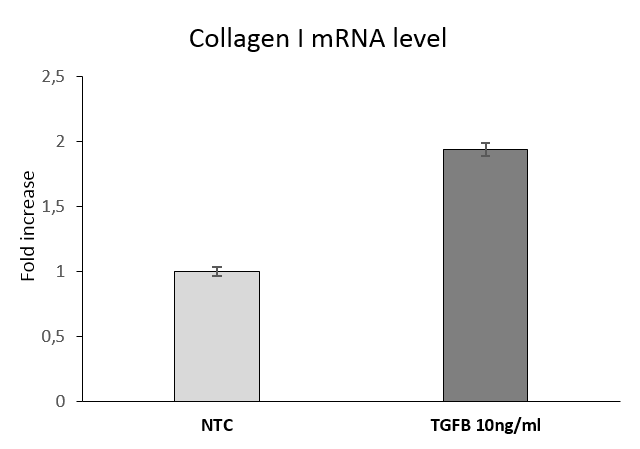 Human TGF-beta 1 Protein 100-B