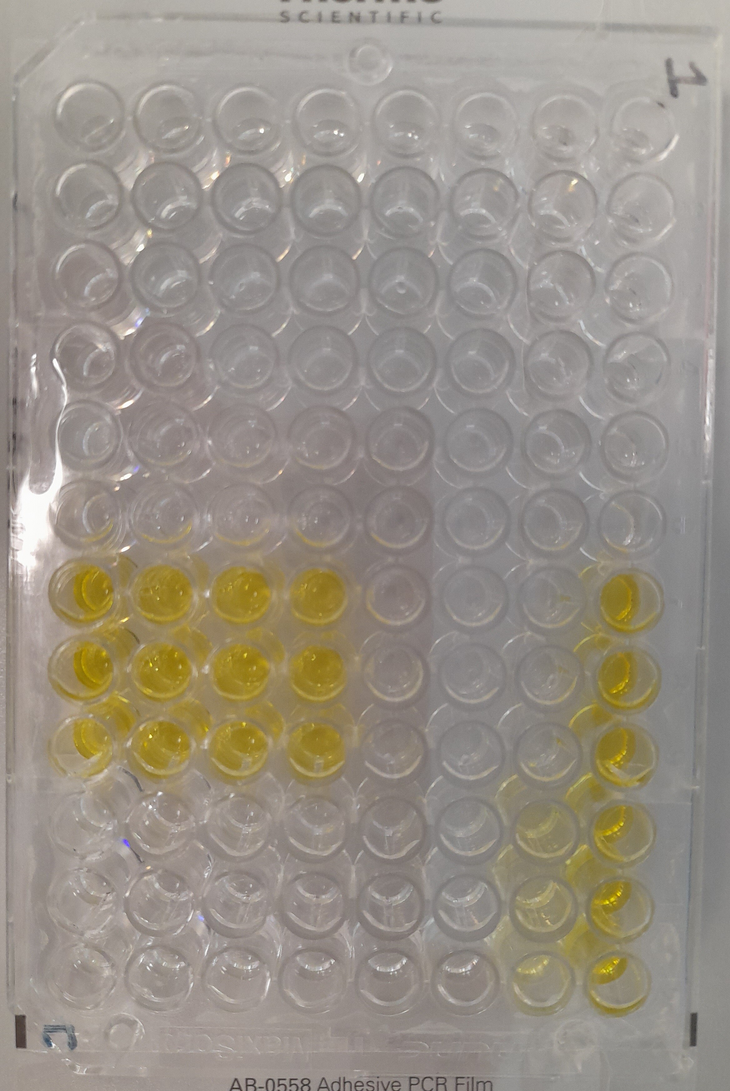 Recombinant SARS-CoV-2 P.1 Spike GCN4-IZ His-tag Protein, CF 10795-CV