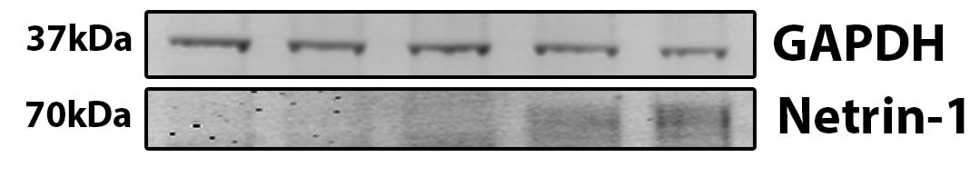 Recombinant Mouse Netrin-1 Protein 1109-N1