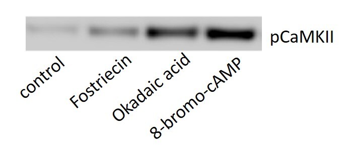 Okadaic acid 1136