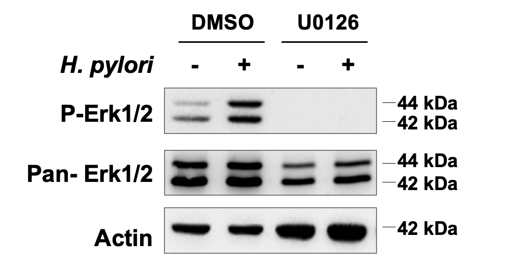 U0126 1144