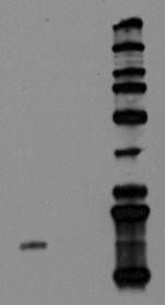 Recombinant Human Galectin-1 Protein 1152-GA
