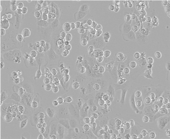 Recombinant Human Galectin-1 Protein 1152-GA