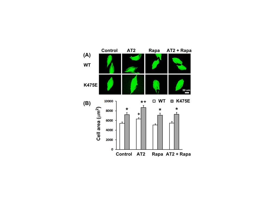 Angiotensin II 1158