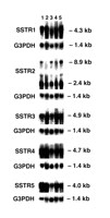 Somatostatin 1-28 1165