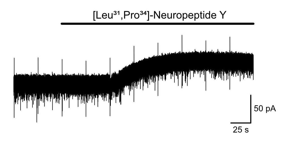 [Leu31,Pro34]-Neuropeptide Y (human, rat) 1176
