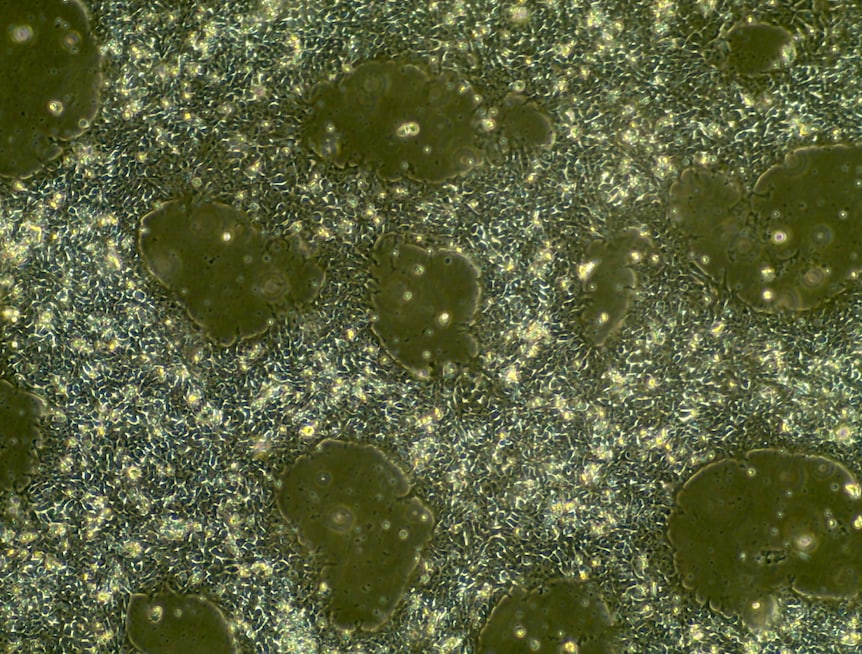 Y-27632 dihydrochloride 1254