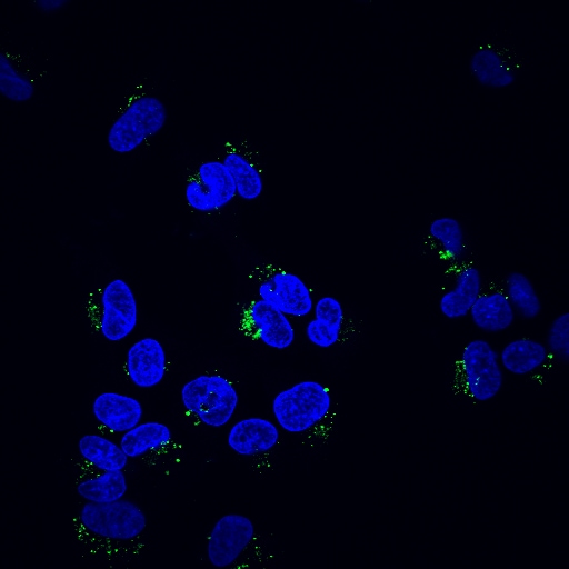 Amyloid β-Peptide (1-42) (human) 1428