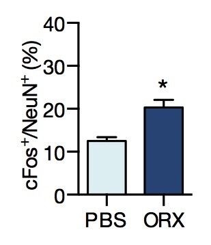 Orexin B (human) 1456