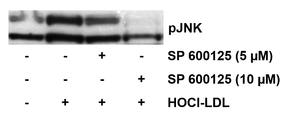 SP 600125 1496