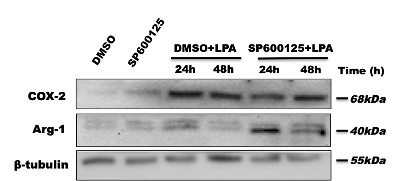 SP 600125 1496