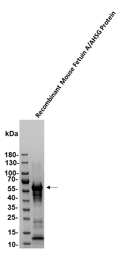 Recombinant Mouse Fetuin A/AHSG Protein, CF 1563-PI