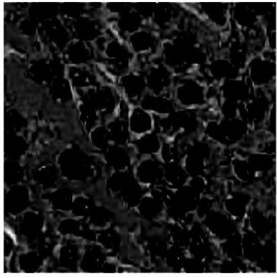 Streptozocin 1621