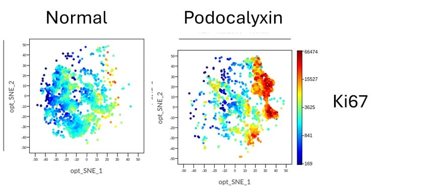 Recombinant Human Podocalyxin Protein, CF 1658-PD