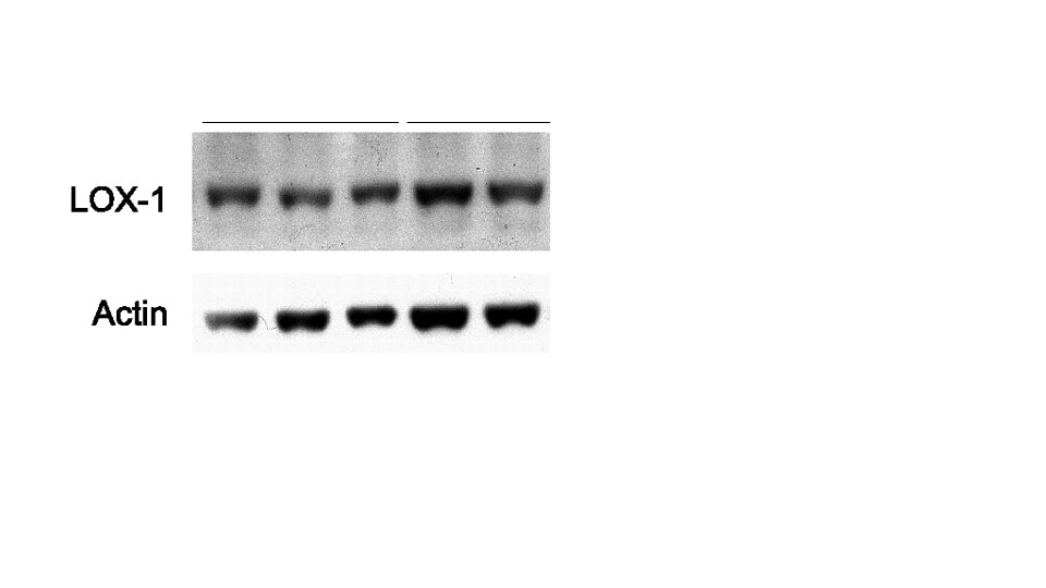 Recombinant Human LOX-1/OLR1 Protein, CF 1798-LX