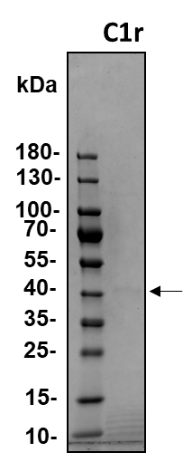 Recombinant Human Complement Component C1r Protein, CF 1807-SE