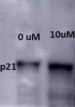 Octreotide 1818
