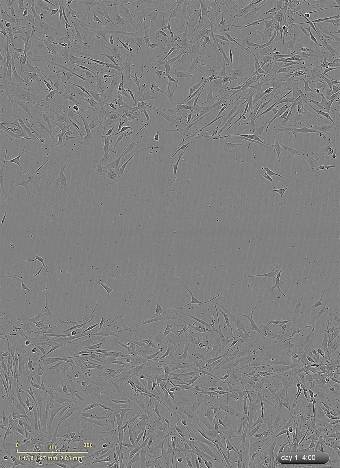 Recombinant Mouse IL-6R alpha (aa 20-357) Protein 1830-SR