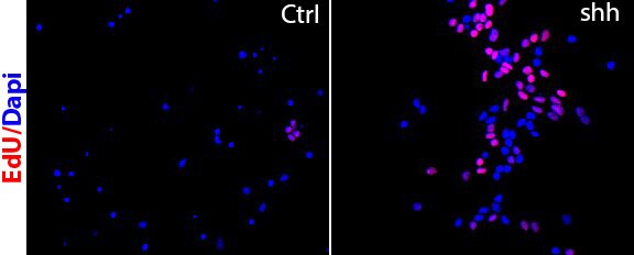 Recombinant Human Sonic Hedgehog/Shh (C24II) N-Terminus 1845-SH