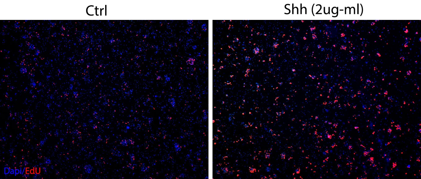 Recombinant Human Sonic Hedgehog/Shh (C24II) N-Terminus 1845-SH
