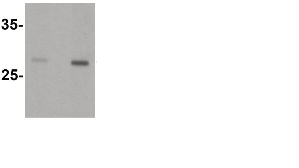 Recombinant Human Dectin-1/CLEC7A Protein, CF 1859-DC
