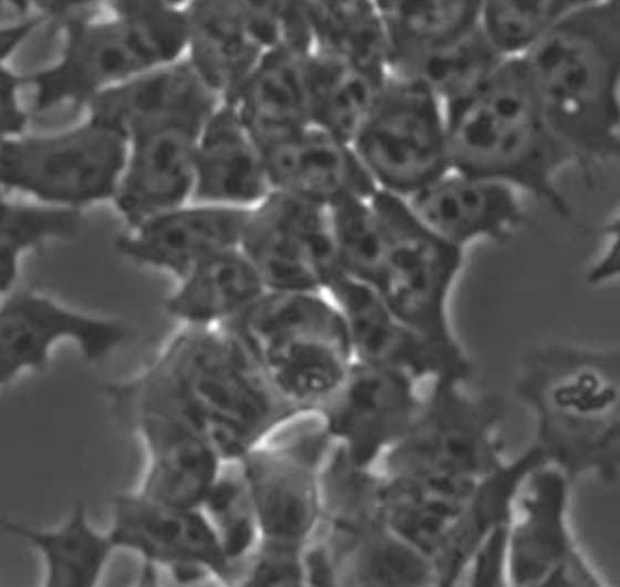 Human Fibronectin Protein, CF 1918-FN
