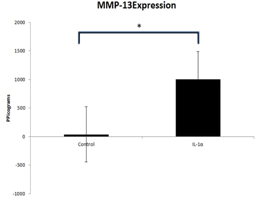 Recombinant Human IL-1 alpha/IL-1F1 Protein 200-LA