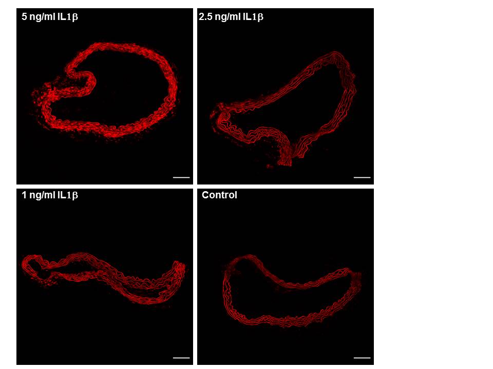 Recombinant Human IL-1 beta/IL-1F2 Protein 201-LB