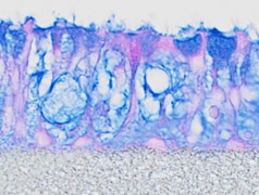 Recombinant Human IL-1 beta/IL-1F2 Protein 201-LB