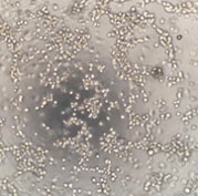 Recombinant Mouse EGF Protein, CF 2028-EG