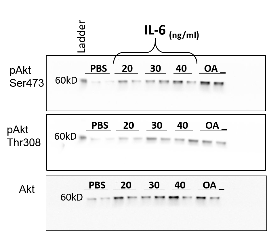 Recombinant Human IL-6 Protein 206-IL