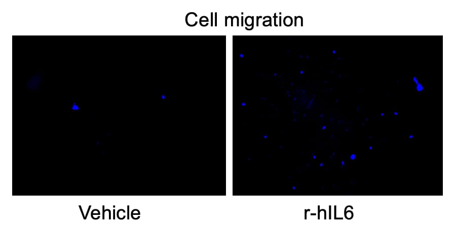Recombinant Human IL-6 Protein 206-IL