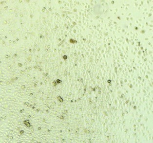 Recombinant Human IL-6 Protein 206-IL