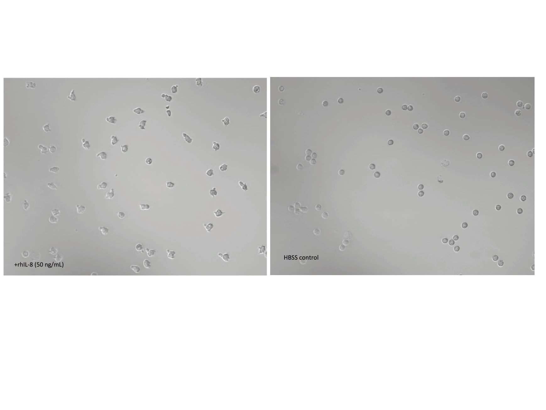 Recombinant Human IL-8/CXCL8 Protein 208-IL